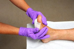 What Are Arterial Ulcers?