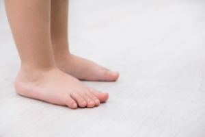 Definition and Causes of Flat Feet in Children