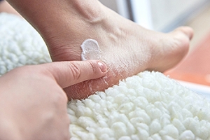 Athlete’s Foot and Cracked Heels