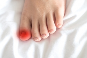 Definition and Complications of Ingrown Toenails