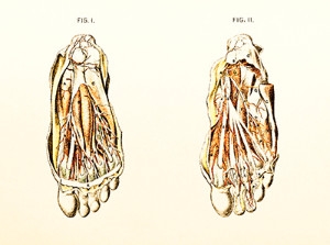 Understanding and Diagnosing Vascular Disease