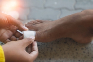Managing Diabetic Foot Blisters
