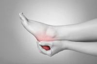 What Leads to Plantar Fasciitis?